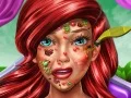 Gêm Meddyg Croen y Frenhines Mermaida ar-lein