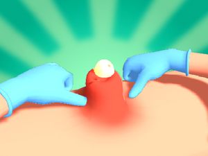 Gêm Gwasgfa pimple ar-lein