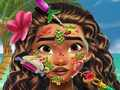 Gêm Meddyg y Croen Moana ar-lein